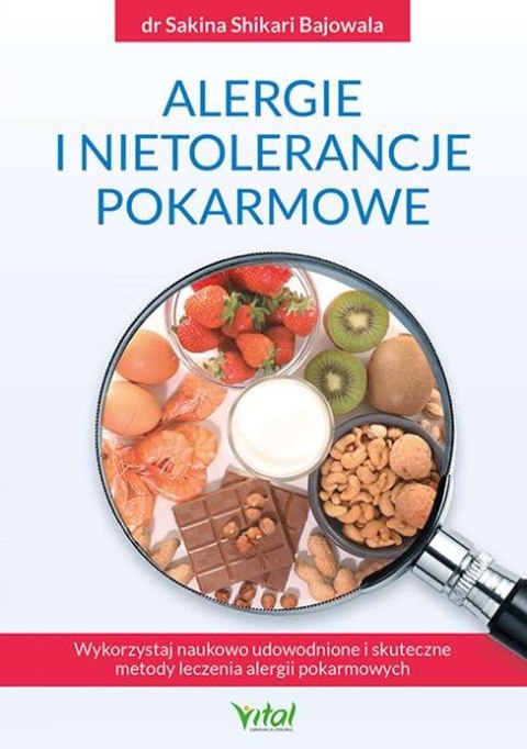 Alergie i nietolerancje pokarmowe. Wykorzystaj naukowo udowodnione i skuteczne metody leczenia alergii pokarmowych