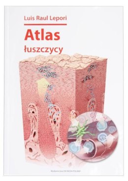 Atlas łuszczycy