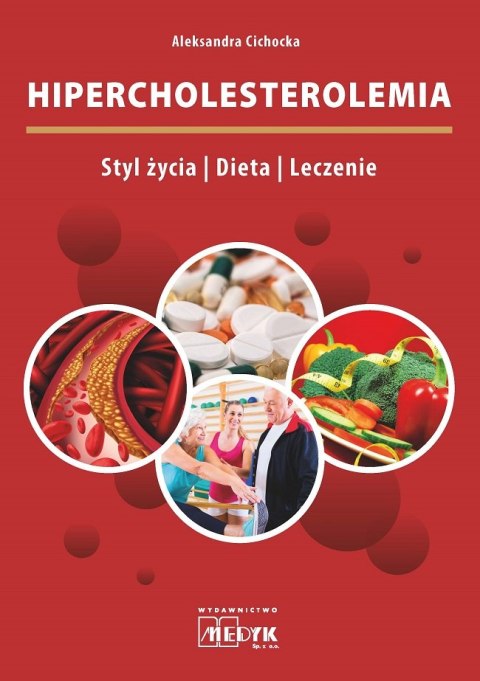 Hipercholesterolemia Styl życia Dieta Leczenie