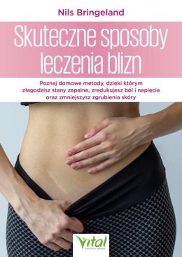Skuteczne sposoby leczenia blizn